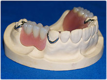 img_denture03.jpg