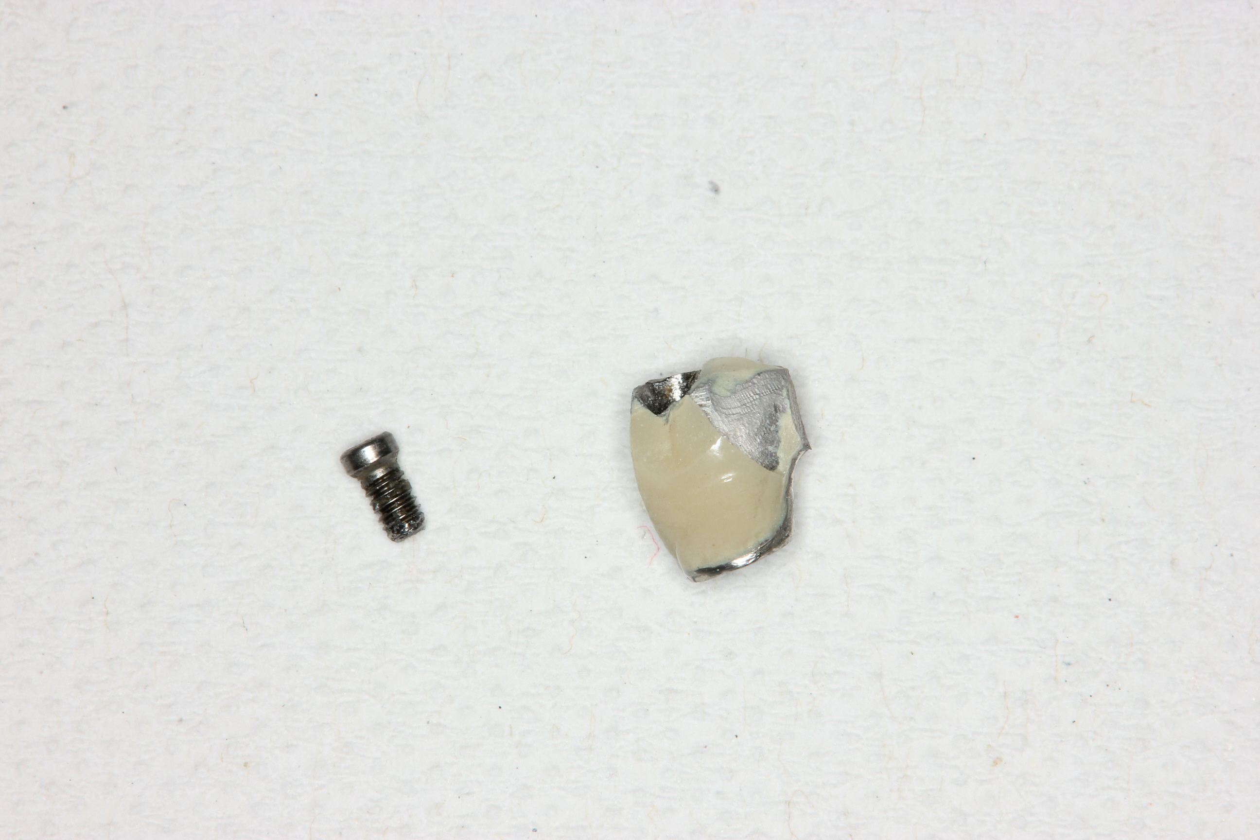 インプラントの長期安定のために – 石神井公園 歯医者 – たけのうち